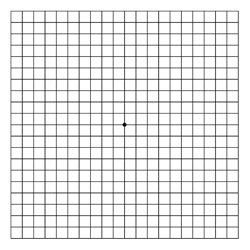 Macular Degeneration Eye Chart Grid