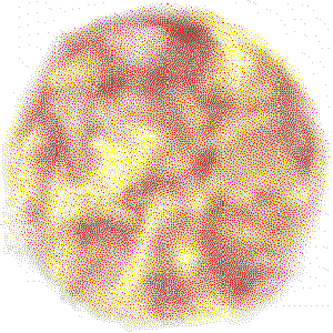 macular degeneration test - Light color blob simulation